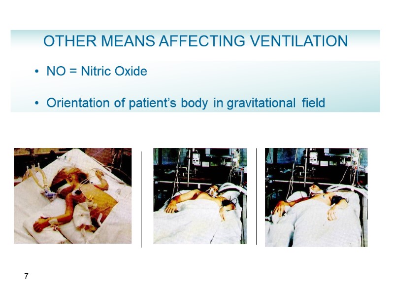 7   NO = Nitric Oxide    Orientation of patient’s body